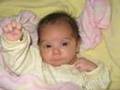 Rachel's Cystic Hygroma