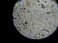 『「たま」のルーペ』で精子を撮影したよ