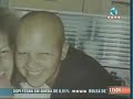 Acabe com a queda de cabelos - Calv�cie