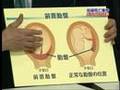 大野病院事件動画13