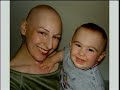 Osteosarcoma Patient Reflects on Cancer Journey