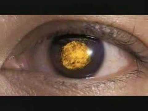 Image de prévisualisation YouTube