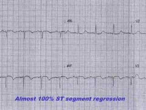 Heparin . . . The forgotten hero in  ...