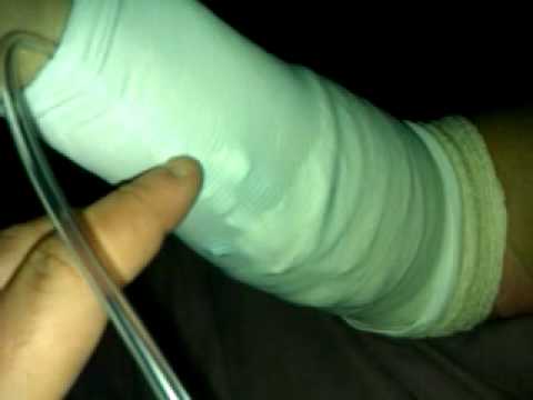 how to administer vancomycin