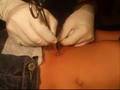 microdermal piercing nőknek - Three microdermal hip piercings