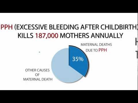 how to treat pph