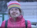 Down syndrome:&nbsp;Down Syndrome: The Memory Keeper's Daughter 2