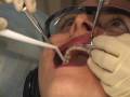dental implants san diego newdentalimplants.net