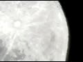 Actividad parsitaria sobre el disco Lunar /glaucoart