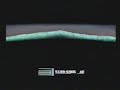 FF7 19 Infinite Elixir Trick, Boss - Ultimate Weapon FF7 19 Infinite Elixir Trick, Boss - Ultimate Weapon
