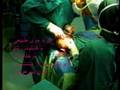 natural hair transplantation