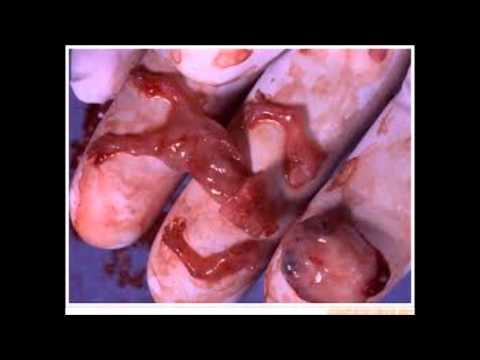 Videos-De-Abortos-Reales de abortos reales - Videos | Videos relacionados con youtube.videos de ...