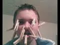 Ross stanley sticks pegs on his face Ross stanley sticks pegs on his face