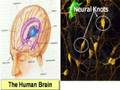 The Cure for Forgetfullness from The Quran