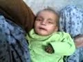 infantile tremor syndrome-2
