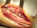 Surgery Surgery