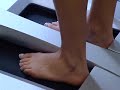 Orthotics and Prosthetics