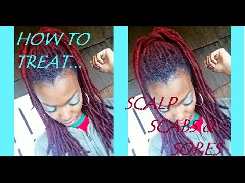 how to treat take all patch