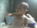 kagat labi memae