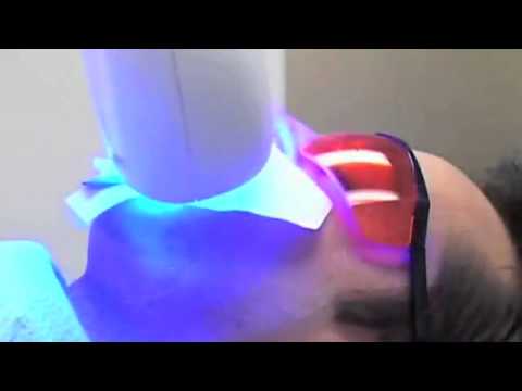 how to whiten teeth while sleeping