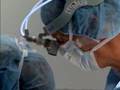 Hepatectomy w/ Radiofrequency Resection