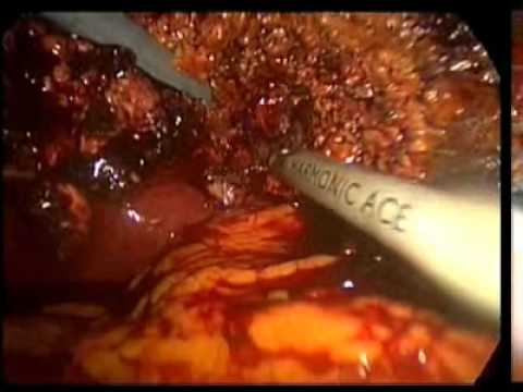 how to isolate liver cells