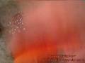 videos de tapeworm 1