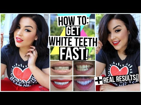 how to get whiter teeth