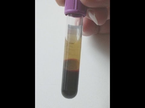 how to isolate buffy coat from whole blood