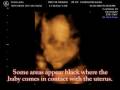 Baby Emma in 4D