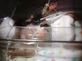 My Little Miracle 1 lb 5 oz