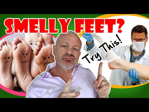 how to treat smelly feet