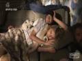 Skins - I bruise easliy