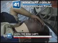 BA?INA V?NÇ BOMU ÇARPTI BA?INA V?NÇ BOMU ÇARPTI