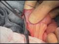 SURGERY OPERATION