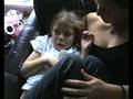 complex partial seizure