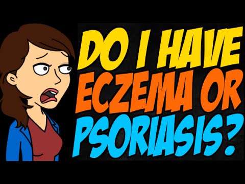 how to have eczema