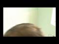 Baldness Problem? Need Hair loss Product That Works & Can Grow Hair Back?