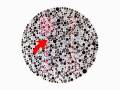 Color Blindness