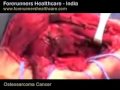 Cost effective Osteosarcoma treatment in India
