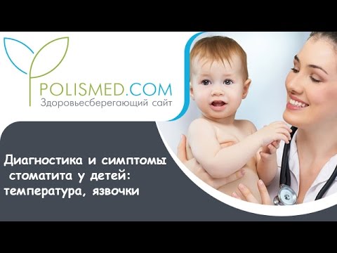 Стоматит у детей как лечить температура 6 день Стоматит у детей как лечить температура 6 день