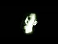 Tardive dyskinesia Accelerated Evolution Tardive dyskinesia Accelerated Evolution