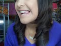 Requested: Braces.