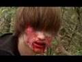 Zombie Attack