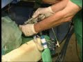 JET Beatmung JET Katheter mit Doppel Lumen Tubus INVIVO