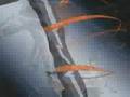 Air gear amv kazzer