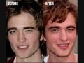 celebrity plastic surgery.wmv
