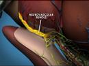Weill Cornell Robotic Prostatectomy: Surgery (4/6)