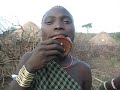 MURSI LIP PLATE REMOVAL