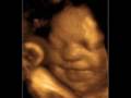 Pro-Life Song & Video (Anti-Abortion)